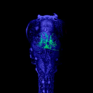Bilden föreställer ett zebrafiskyngel med cancerceller (gröna) i nervsystemet. Forskarna använde denna typ av djurmodell för att utvärdera nya behandlingar. Bild: Elin Almstedt