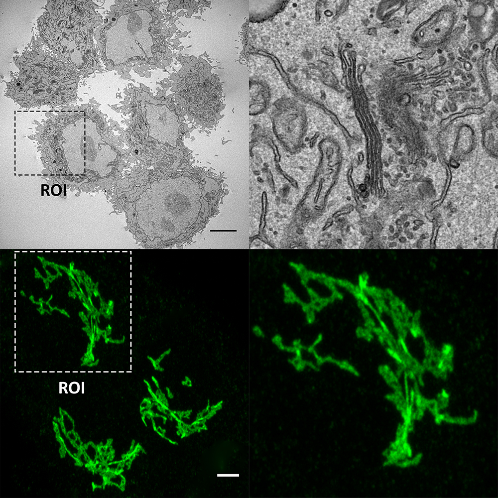 Golgi apparatus in Hela Cells; Top: Transmission electron micrograph; and, bottom: Laser scanning confocal microscopy image of Golgi-resident glycosylation enzyme, N-acetylgalactosaminyltransferase-2 fused to green fluorescent protein. Enlarged regions of interest (ROI) are shown in the 2 right panels. scale bar 5 µm
